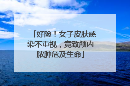好险！女子皮肤感染不重视，竟致颅内脓肿危及生命