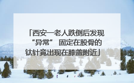 西安一老人跌倒后发现“异常” 固定在股骨的钛针竟出现在膝盖附近